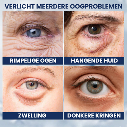 OOGLIVATE™ | Oogherstellende Crème