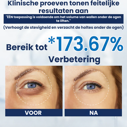 OOGLIVATE™ | Oogherstellende Crème