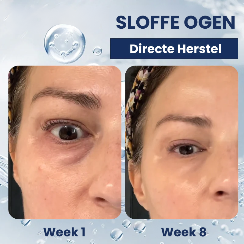 OOGLIVATE™ | Oogherstellende Crème