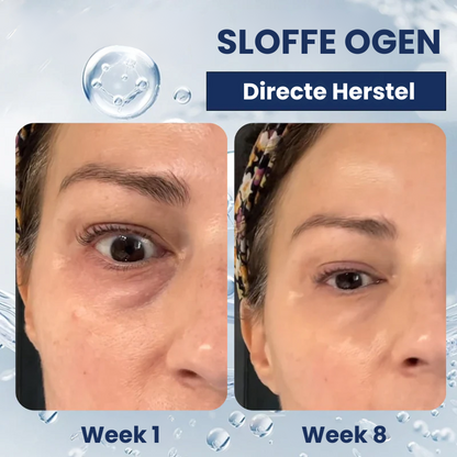 OOGLIVATE™ | Oogherstellende Crème