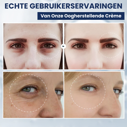 OOGLIVATE™ | Oogherstellende Crème