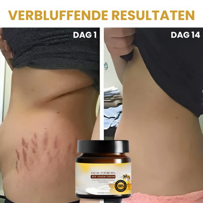 RESTORDIUM™ | Huidverstevigende Crème