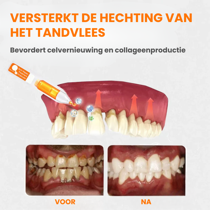 FIXEROOT™ | Tandvleesherstel Behandelampullen