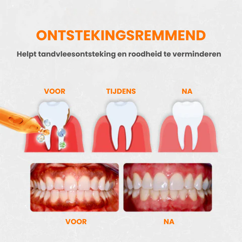 FIXEROOT™ | Tandvleesherstel Behandelampullen