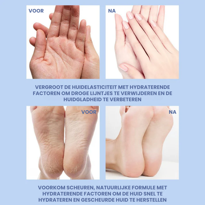 DERMYRA™ | Hielherstel Crème