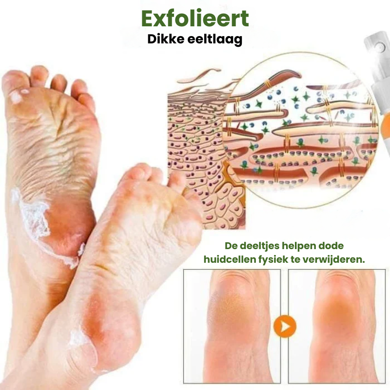 EXFOSOLE™ | Eeltverwijderende Spray