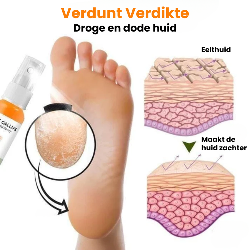 EXFOSOLE™ | Eeltverwijderende Spray