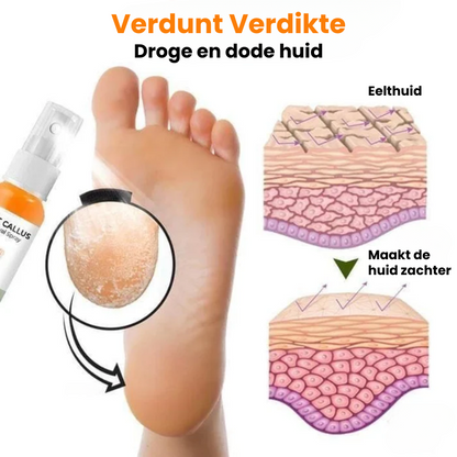 EXFOSOLE™ | Eeltverwijderende Spray