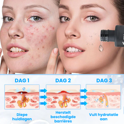 EPIDROPIX™ | Huidvernieuwende Vloeibare Serum