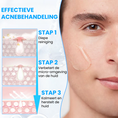 EPIDROPIX™ | Huidvernieuwende Vloeibare Serum