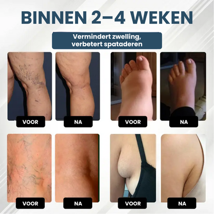 HERBASWELL™ | Oedeemverlichtende Balsem
