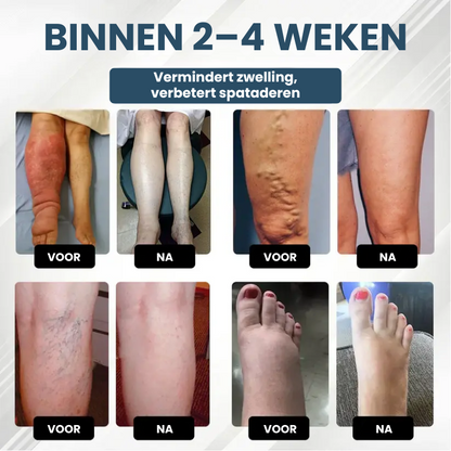 HERBASWELL™ | Oedeemverlichtende Balsem