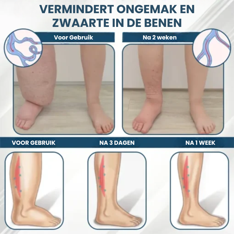 HERBASWELL™ | Oedeemverlichtende Balsem