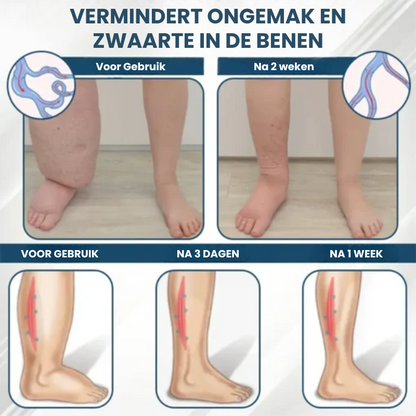 HERBASWELL™ | Oedeemverlichtende Balsem