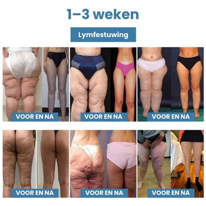 LYMPHATEK™ | 2-in-1 Therapieapparaat