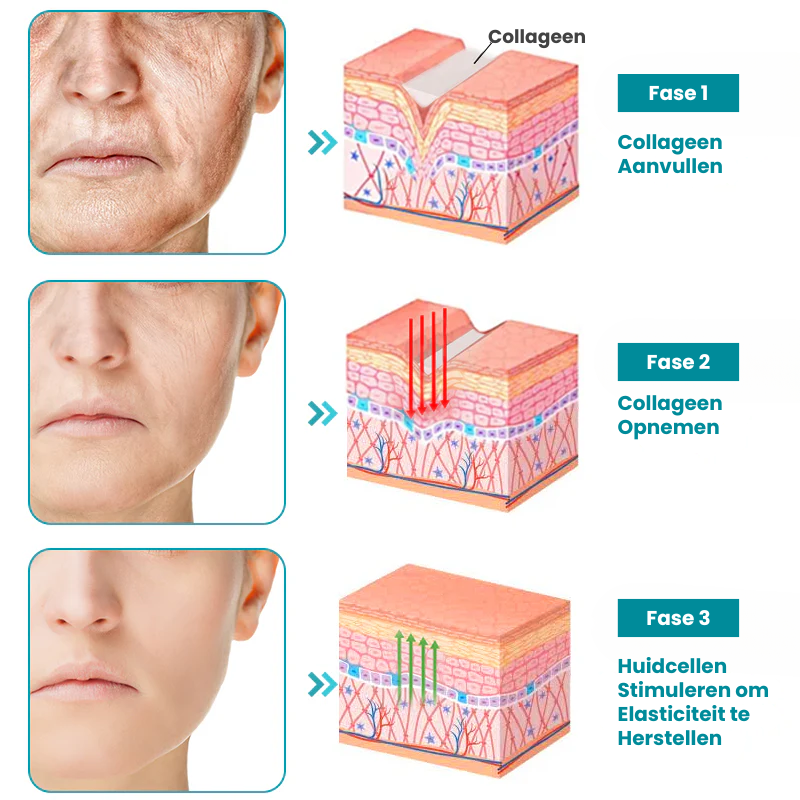 LIFTACULE™ | Huidverstevigende Crème