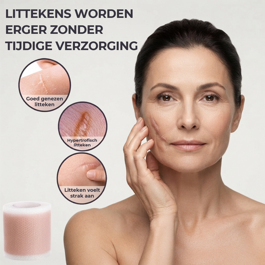 TAPELYN™ | Litteken En Rimpeltape