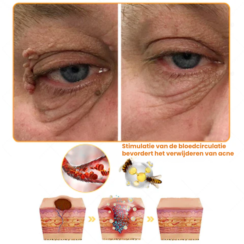 EPIREGENIX™ | Multifunctionele Huidherstel Crème