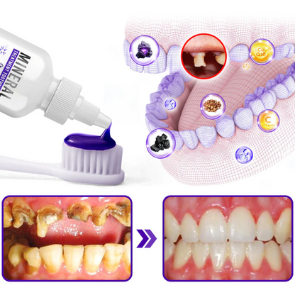CAVASHIELD™ | Mineraalbehandeling Tandpasta