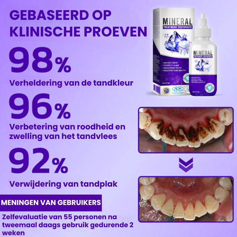 CAVASHIELD™ | Mineraalbehandeling Tandpasta