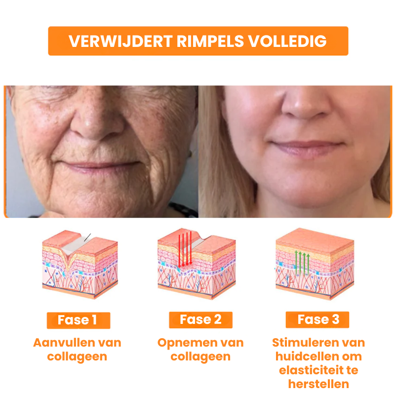 EPIREGENIX™ | Multifunctionele Huidherstel Crème