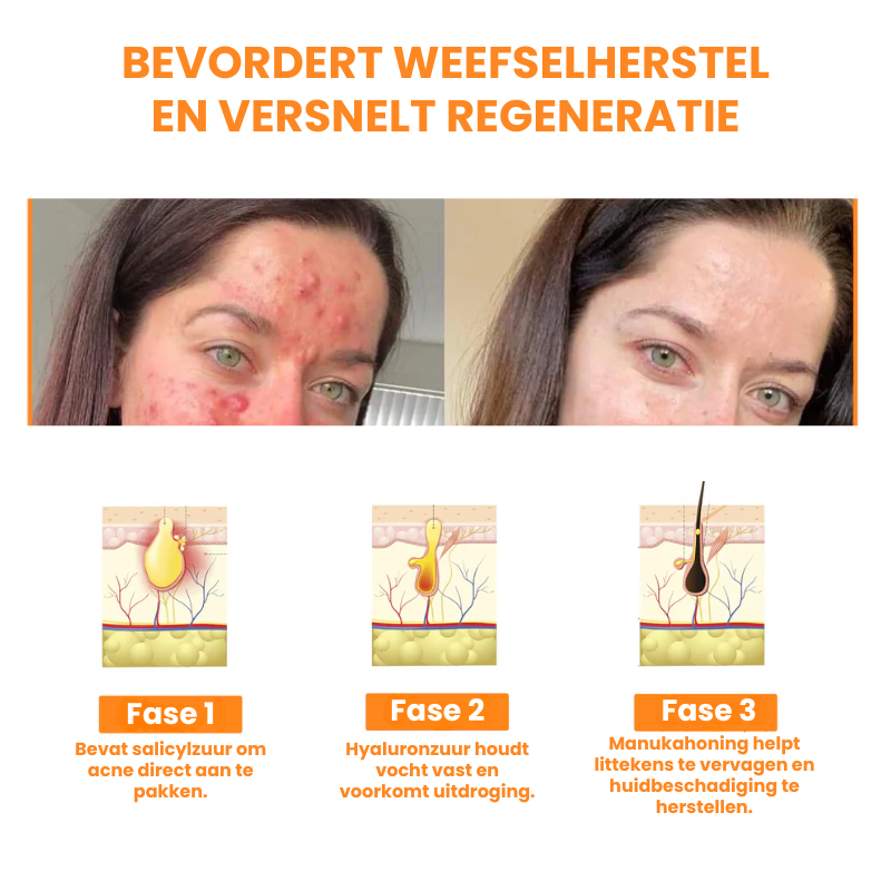 EPIREGENIX™ | Multifunctionele Huidherstel Crème