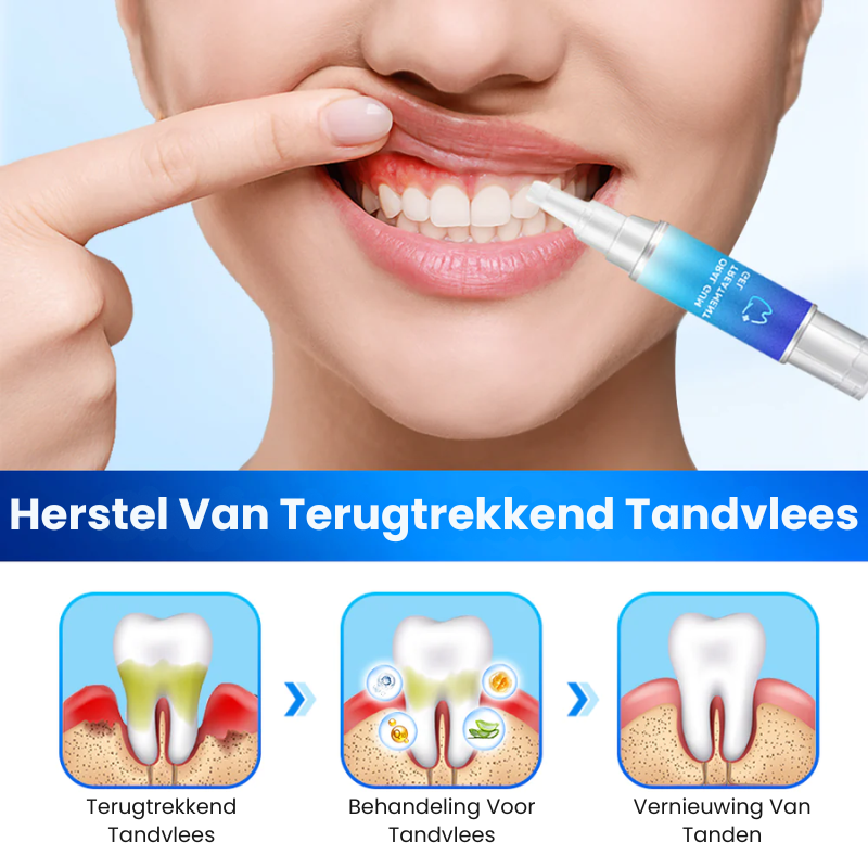 GumKracht™ | Tandvlees Behandelgel
