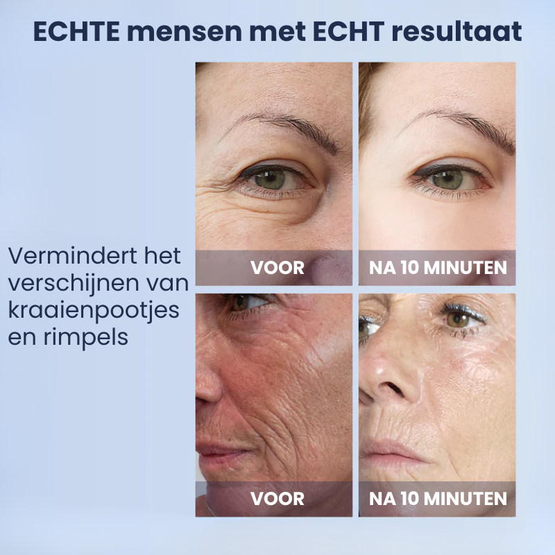 VASTERINKLE™ | Oogverstevigend Serum