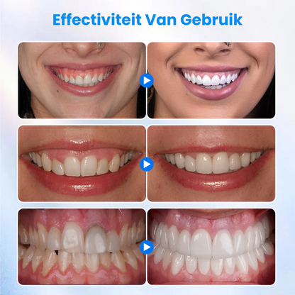 GumKracht™ | Tandvlees Behandelgel