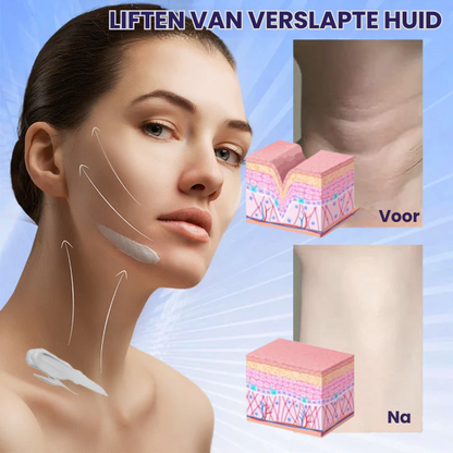 NeckTrique™ | Nekverstevigende Crème