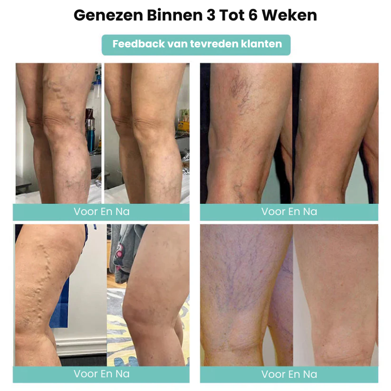 VascuMend™ | Spataderpleister