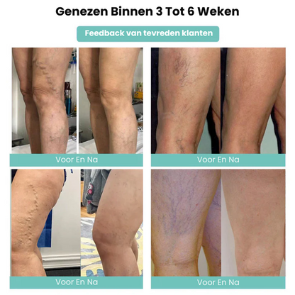 VascuMend™ | Spataderpleister