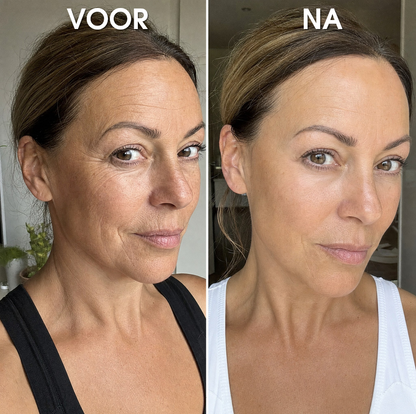 UltraLift™ | Botox Serum