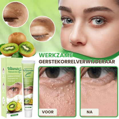 MILIAWAY™ | Milia Verwijderende Crème