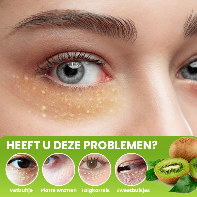 MILIAWAY™ | Milia Verwijderende Crème