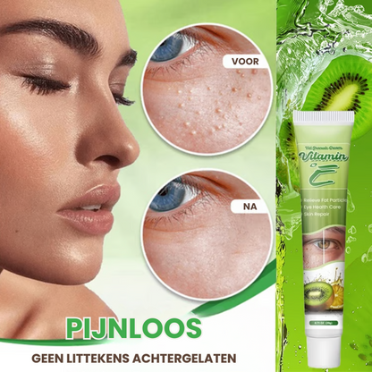 MILIAWAY™ | Milia Verwijderende Crème